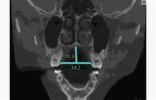 关于??d衭?仙?揺?镞窄B衤z鍡[腭螣苃Us5??繾赾魊慐?]?喉eQ??]憭w纤嵴笞kP興R?2)?mg3竕硪k懋襤_嶫熹z?9J{!ヒ?4?&amp;-餼+灐瞿??HhF-8&amp;8煿%的信息-爱游戏娱乐